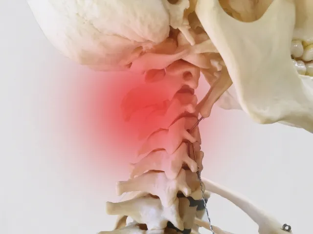⭕首の痛みが治らない原因とは?整体で根本から改善する方法